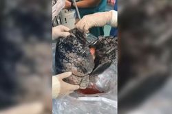 Video bộ phổi đen sì của người nghiện thuốc lá