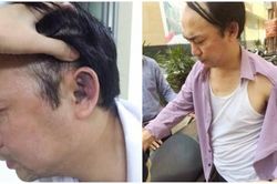 Cần sớm điều tra, xử lý nghiêm vụ cố ý gây thương tích ở Hà Đông