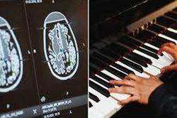 Bệnh nhân vừa chơi piano vừa được phẫu thuật u não