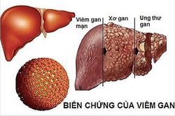 Tầm soát sớm ung thư tế bào gan