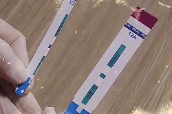 Chủ tịch Hà Nội yêu cầu xử nghiêm vụ cắt đôi que thử HIV, viêm gan B