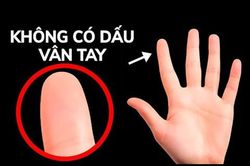 Chuyện gì sẽ xảy ra nếu bạn mất dấu vân tay?