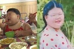 Lúc 2 tuổi 'ăn như thuồng luồng' nặng tới 43 kg, cô gái khiến mọi người bất ngờ vì vóc dáng hiện tại
