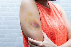 12 dấu hiệu bất thường trên cơ thể 'cảnh báo' những căn bệnh nguy hiểm