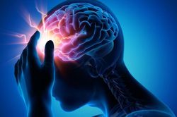 Những biến chứng nguy hiểm thường gặp sau khi bị đột quỵ