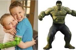 Bé trai đầu tiên ở Anh được lắp tay giả trên khuỷu với cảm hứng từ Người khổng lồ xanh
