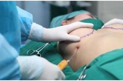 Chi cả núi tiền nâng ngực, 'núi đôi' bỗng biến thành '4 cục u' kỳ lạ