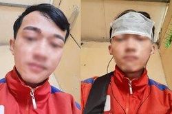 'Đỡ không nổi' với màn điêu khắc lông mày thảm họa của nam thanh niên muốn 'một lần chơi lớn xem thiên hạ có trầm trồ'