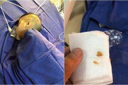 Bé trai nguy kịch vì thói quen nhiều mẹ vẫn chiều khi cho con ăn