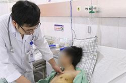 Nam thanh niên xẹp phổi, nguy kịch sau 5 năm hút thuốc lá