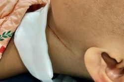 Điện thoại bị hỏng giữa lớp học, nam sinh 'nổi điên' dùng dao cắt cổ bạn cùng lớp để xả giận