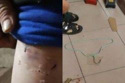 Người đàn ông khuyết tật tố bị vợ bạo hành trong nhiều năm và phản ứng gay gắt của cộng đồng mạng