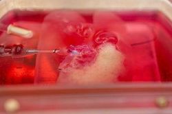 Lần đầu tiên trên thế giới in 3D thành công lá gan người có đầy đủ chức năng sống