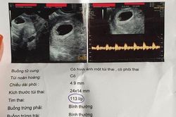 Phẫn nộ khi nhận được giấy siêu âm thai của chồng với vợ cũ, cô gái đăng đàn chia sẻ lại nhận được ý kiến gây sốc thế này