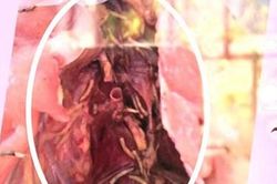Vật nghi dòi trong thức ăn học sinh là sâu canxi
