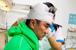 Đàm Vĩnh Hưng bị tai nạn chảy máu đầu, phải nhập viện băng bó