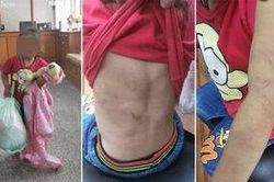 Mẹ bỏ con gái 2 tuổi mình đầy vết sẹo và bầm tím trước cửa trung tâm phúc lợi vì lý do xót xa