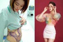Hotgirl Trâm Anh khoe eo thon sau khi hút mỡ bụng 3 tháng