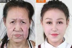 Thiếu nữ 15 tuổi mang gương mặt bà lão 'lột xác' đến ngỡ ngàng