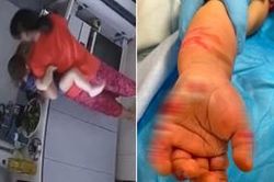 Người giúp việc nhúng tay bé gái 16 tháng tuổi vào nước sôi với lý do khó tha thứ