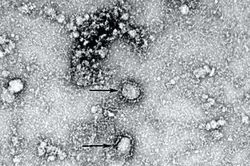 Công bố hình ảnh đầu tiên về virus corona