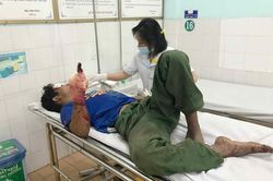 Dùng mìn đánh cá, 1 thanh niên bị thương nặng bàn tay