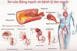 Một số chứng bệnh tim nguy hiểm thường gặp