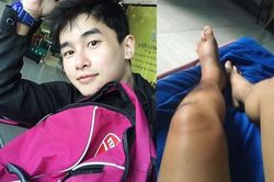 Nam diễn viên Thái Lan qua đời do ung thư da, luôn giữ thái độ lạc quan khi chiến đấu với căn bệnh quái ác