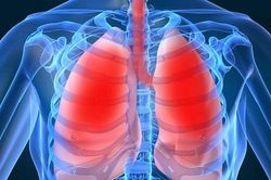 Làm thế nào để biết mình có bị lao phổi hay không?