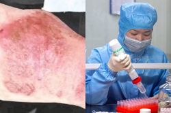 Bàn tay sưng đỏ của bác sĩ làm 12 tiếng/ngày tại Vũ Hán