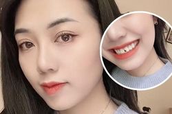 'Ngứa răng' cắn móng tay, gái xinh gặp hạn nhưng vẫn chiếm spotlight