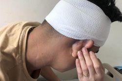 Tài xế bị nhóm đối tượng đánh nhập viện vì mâu thuẫn của… ông chủ