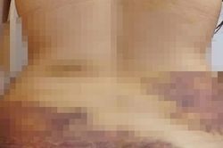 Người phụ nữ trẻ ở Tây Ninh nghi bị chồng bạo hành dã man