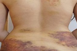 Xác minh thông tin người phụ nữ bị chồng bạo hành dã man ở Tây Ninh