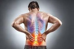 Chớ xem thường đau lưng cơ năng
