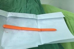 Cứu sống bệnh nhân tâm thần tự dùng muỗng đâm vào mắt
