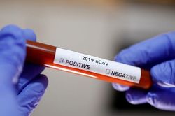 Virus corona quá 'xảo quyệt', bệnh nhân xét nghiệm lần thứ 5 mới biết nhiễm bệnh