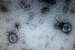 Việt Nam là 1 trong 4 nước phân lập thành công virus corona chủng mới