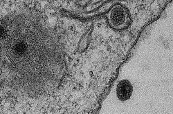 Phát hiện chủng virus mới có nguồn gốc amip