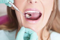 Người phụ nữ mọc lông trong miệng