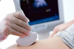 Các mốc siêu âm, khám thai mẹ bầu cần nhớ để sinh con khỏe mạnh