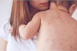 Các bệnh truyền nhiễm ở Việt Nam được kiểm soát tốt trong đầu năm 2020