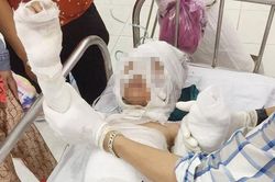 Mâu thuẫn tiền bạc, dì ruột châm xăng đốt cháu gây bỏng nặng