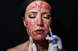 Lột da và những phương pháp làm đẹp đau nhất thế giới