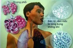 Ẩm ướt, cảnh giác với nấm phổi