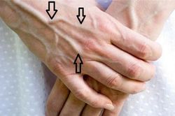 Dấu hiệu trên bàn tay cảnh báo gan đang nhiễm độc, 'nhàu nát' từng ngày, nguy hại nhất là số 1