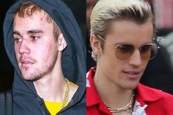 Vẻ ngoài thất thường của Justin Bieber