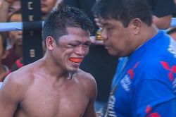 Dính đòn nặng, võ sĩ Philippines sưng hết hai mắt
