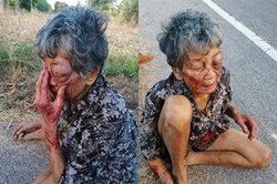 Cơ thể dày đặc vết thương của cụ bị cháu trai nghiện rượu bạo hành thậm tệ