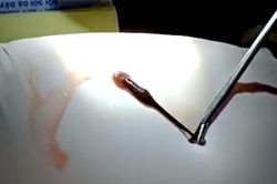 Kinh hãi phát hiện con đỉa 3cm trong hốc mũi